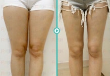 블라인드 | 블라블라: 여자 다리 블라블라: 여자 다리