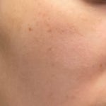 더메디닥터(The Medi Dr.) 링톤 파워리뷰 by ㅌㅣ거 - 언니의파우치