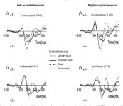[PDF] Why is the N170 enhanced for inverted faces? An ERP competition experiment | Semantic Scholar
