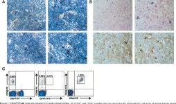 [PDF] CD56bright natural killer cells are present in human lymph nodes and are activated by T cell-derived IL-2: a potential new... 