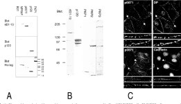 PKP4 gene | Semantic Scholar