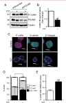 PDLIM2 protein, human | Semantic Scholar