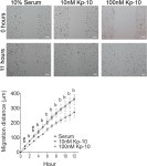 [PDF] GPR54 (KISS1R) Transactivates EGFR to Promote Breast Cancer Cell Invasiveness | Semantic Scholar