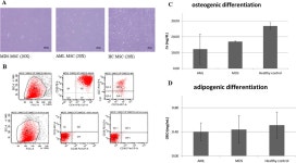 DICER1 gene and miRNA dysregulation in mesenchymal stem cells of patients with myelodysplastic syndrome and acute myeloblastic... 