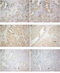 [PDF] Expression of Kisspeptin (KISS1) and its Receptor GPR54 (KISS1R) in Prostate Cancer | Semantic Scholar
