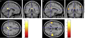 [PDF] Education-Adjusted Normality Thresholds for FDG-PET in the Diagnosis of Alzheimer Disease | Semantic Scholar