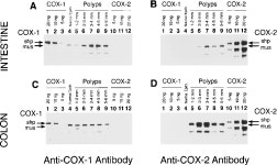 Suppression of Intestinal Polyposis in ApcΔ716 Knockout Mice by Inhibition of Cyclooxygenase 2 (COX-2) | Semantic Scholar