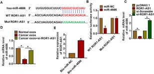 [PDF] Exosomal lncRNA ROR1-AS1 Derived from Tumor Cells Promotes Glioma Progression via Regulating miR-4686 | Semantic Scholar