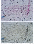 [PDF] Autologous transplantation of bone marrow cells improves damaged heart function. | Semantic Scholar