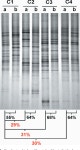 The Gut Microbiota Predispose to the Pathophysiology of Acute Postradiotherapy Diarrhea | Semantic Scholar