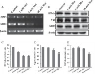 [PDF] Metformin reverses multidrug resistance in human hepatocellular carcinoma Bel-7402/5-fluorouracil cells | Semantic Scholar
