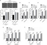 [PDF] PTPRU, As A Tumor Suppressor, Inhibits Cancer Stemness By Attenuating Hippo/YAP Signaling Pathway | Semantic Scholar