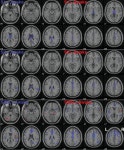 [PDF] Brain activation and hypothalamic functional connectivity during human non-rapid eye movement sleep: an EEG/fMRI study.... 