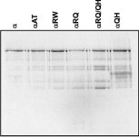 [PDF] Functional defects due to spacer-region mutations of human mitochondrial DNA polymerase in a family with an ataxia-myopathy... 