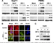 [PDF] Human Immunodeficiency Virus Type 1 Mediates Global Disruption of Innate Antiviral Signaling and Immune Defenses within... 