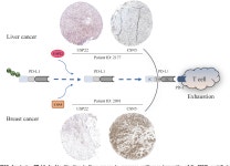 [PDF] Blocking PD-L1 for anti-liver cancer immunity: USP22 represents a critical cotarget | Semantic Scholar