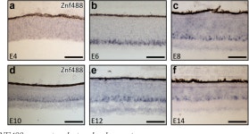 The identification of developmental mechanisms and signatures of mature retinal neurons through single cell transcriptomics... 