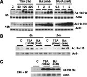 [PDF] Combined effects of retinoic acid and histone deacetylase inhibitors on human neuroblastoma SH-SY5Y cells | Semantic Scholar