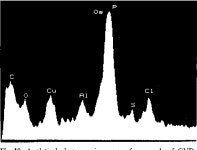 Granulovacuolar degeneration | Semantic Scholar