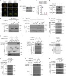 L3MBTL1 gene | Semantic Scholar