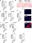 [PDF] Antifibrotic Soluble Thy-1 Correlates with Renal Dysfunction in Chronic Kidney Disease | Semantic Scholar