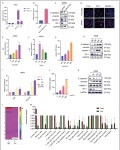 [PDF] ERO1L promotes IL6/sIL6R signaling and regulates MUC16 expression to promote CA125 secretion and the metastasis of lung... 