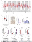 [PDF] ERO1L promotes IL6/sIL6R signaling and regulates MUC16 expression to promote CA125 secretion and the metastasis of lung... 