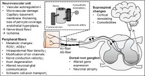 [PDF] Challenges of neuropathic pain: focus on diabetic neuropathy | Semantic Scholar