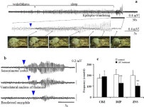 [PDF] Rats Harboring S284L Chrna4 Mutation Show Attenuation of Synaptic and Extrasynaptic GABAergic Transmission and Exhibit the... 