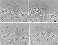 [PDF] Mechanism of centrosome positioning during the wound response in BSC-1 cells | Semantic Scholar