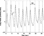[PDF] Quantifying Fractal Dynamics of Human Respiration: Age and Gender Effects | Semantic Scholar