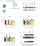 TBL1XR1 Ensures Balanced Neural Development Through NCOR Complex-Mediated Regulation of the MAPK Pathway | Semantic Scholar