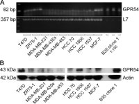 Antiproliferative effects of kisspeptin‑10 depend on artificial GPR54 (KISS1R) expression levels. | Semantic Scholar
