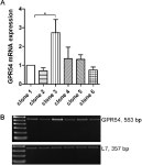 Antiproliferative effects of kisspeptin‑10 depend on artificial GPR54 (KISS1R) expression levels. | Semantic Scholar