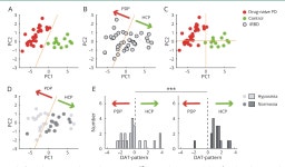 Longitudinal change in dopamine transporter availability in idiopathic REM sleep behavior disorder | Semantic Scholar