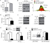 Regulation of SOD2 and β-arrestin1 by interleukin-6 contributes to the increase of IGF-1R expression in docetaxel resistant... 