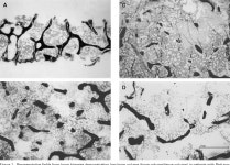 Possible Mechanisms of Osteopenia in Rett Syndrome: Bone Histomorphometric Studies | Semantic Scholar