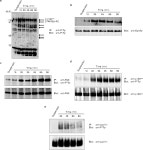 EphrinA1-induced cytoskeletal re-organization requires FAK and p130cas | Semantic Scholar