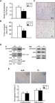 Mice lacking MAP kinase phosphatase-1 have enhanced MAP kinase activity and resistance to diet-induced obesity. | Semantic Scholar