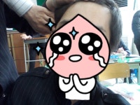 [23세탈모] 라인 올라간거 같아?? 23세탈모 라인 올라간거 같아