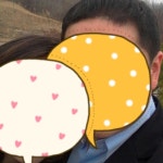 [복합처방] 울산현대약국 처방 후기 | 모발이식 후기, 리뷰, 비용은 대다모!