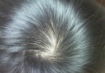 이식한지 5개월이 조금 넘었는데요.... 이식한지 5개월이 조금 넘었는데요