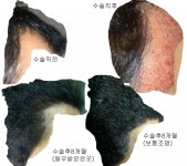 알마니 8개월 후기 및 주저리... 알마니 8개월 후기 및 주저리... | 모발이식 후기,리뷰,비용은 대다모!