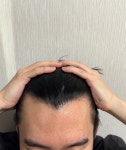 XQ Hair(엑스큐 헤어) | [정수리 탈모] 엑스펙타 님의 Hair bnb 여행지 | 대한민국 1등 탈모 커뮤니티 대다모