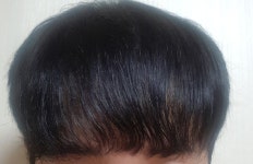 이식한지 9개월정도 됫습니다. 이식한지9개월정도됫습니다