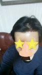 [남성탈모] 모힐의원 수술1일차 | 모발이식 후기, 리뷰, 비용은 대다모!