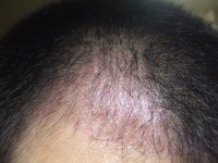 2개월 하고도 보름... 2개월하고도보름