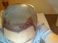 세브멕 데니즈 에이젼시 오늘 복귀 후기 ^^ 세브멕데니즈에이젼시오늘복귀후기