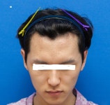나세르에서 헤어라인했습니다 나세르에서헤어라인했습니다