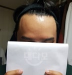 두드림성형외과 3350모 비절개 당일 내 돈 주고 쓰는 후기 두드림성형외과3350모비절개당일내돈주고쓰는후기
